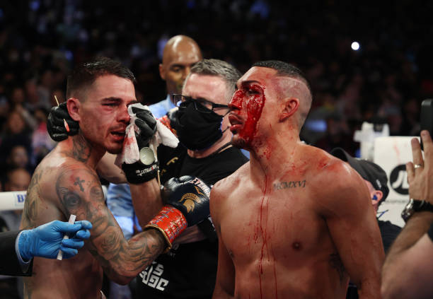 Josh Taylor Vows To Retire And Behead 'Mentally Weak' Teofimo Lopez image 2